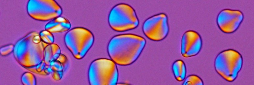 Starch assessment Starch assessment
